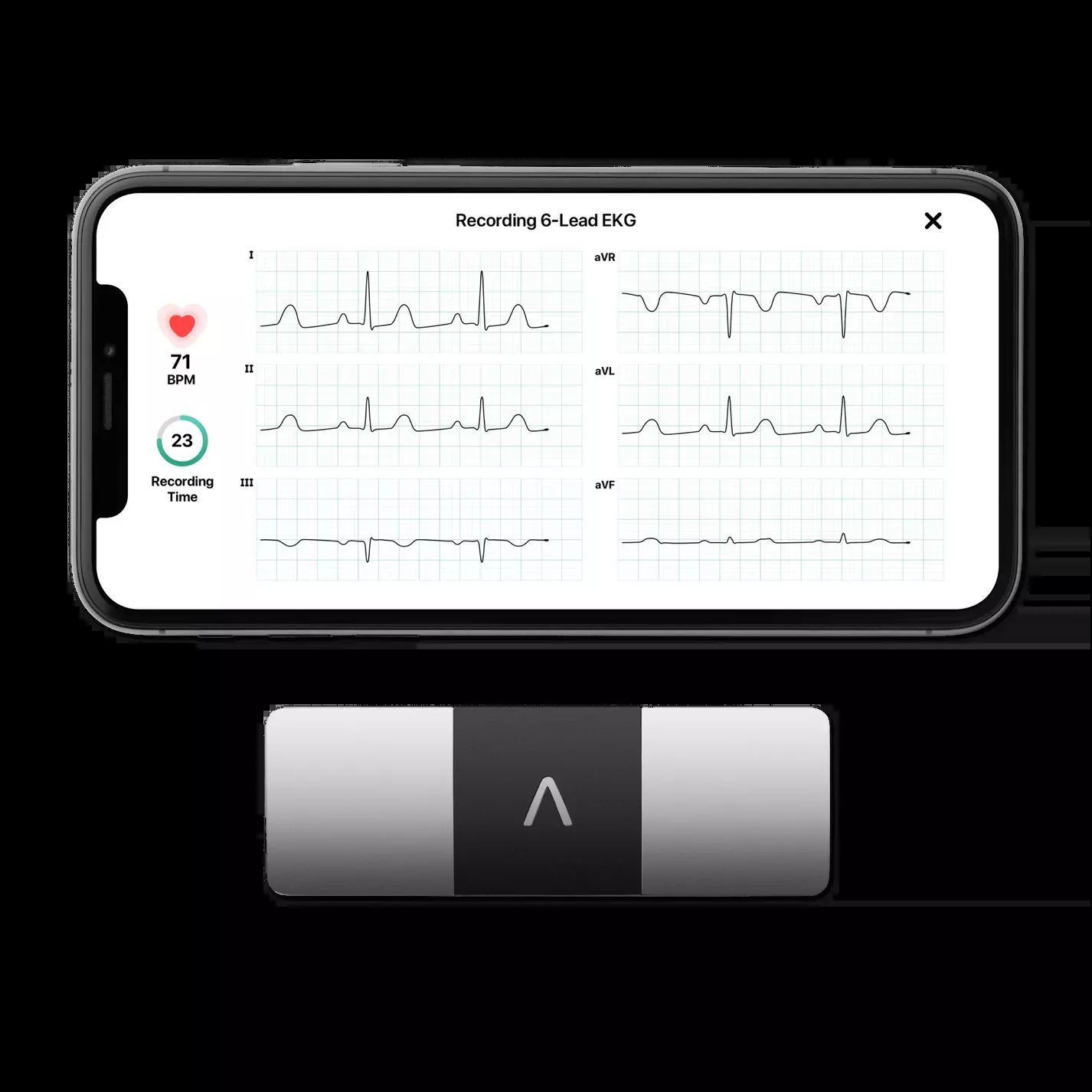 AliveCor KardiaMobile 6 Lead EKG