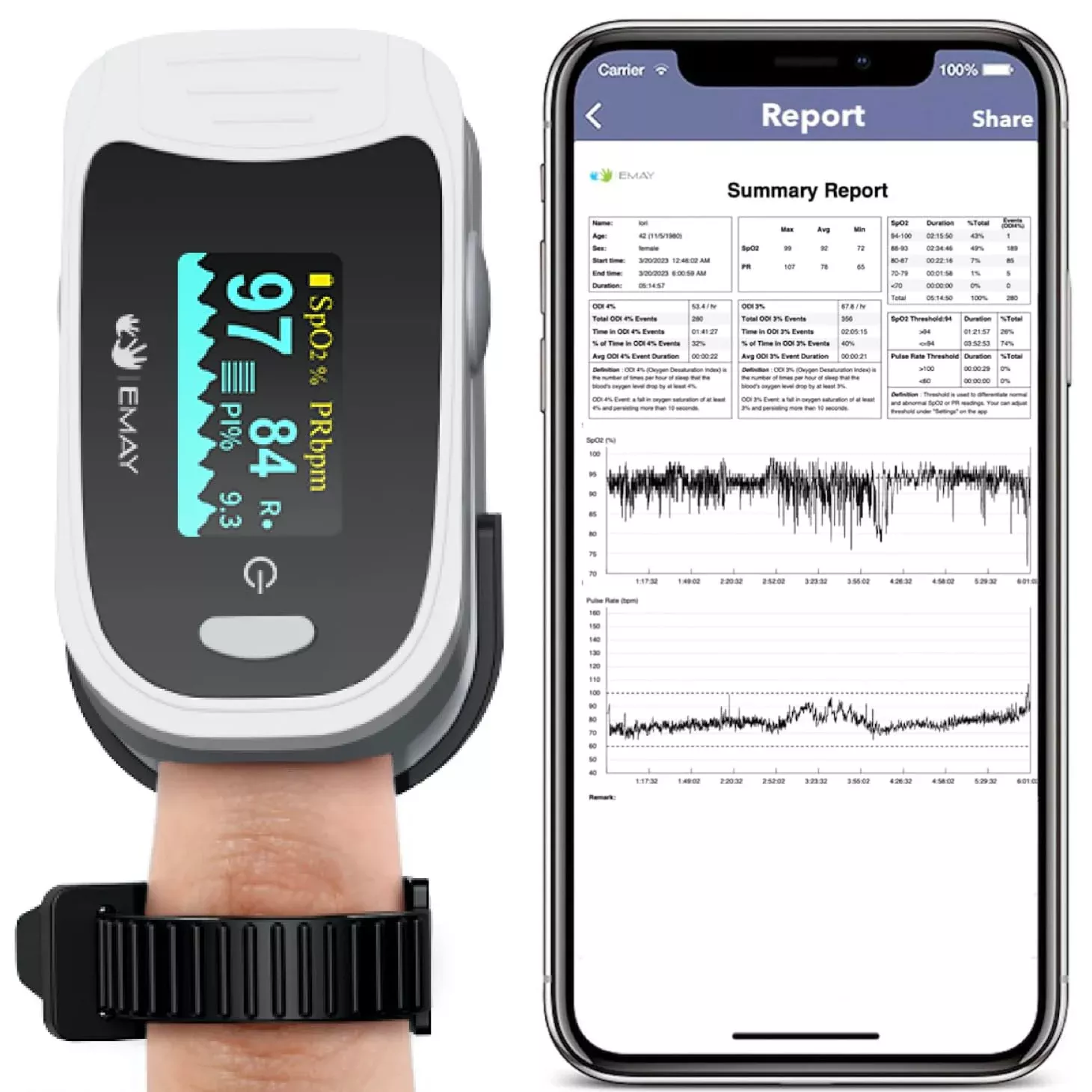 Emay EMO-80 Continuous Pulse Oximeter [Bluetooth]