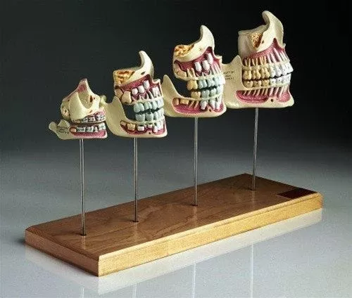 Four Teeth and Jaw Development Set Models, Newborn to Adult