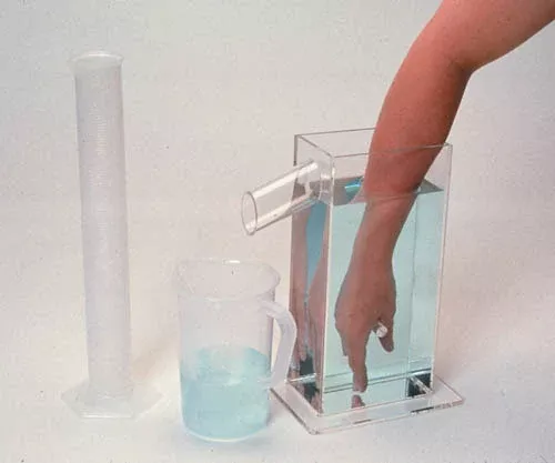 Hand Volumetric Edema Evaluation Set