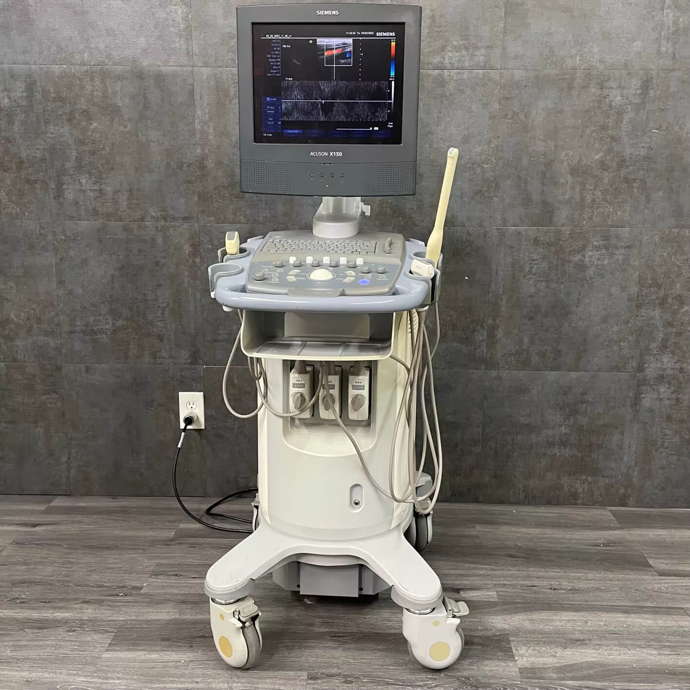 Siemens Acuson X150 Diangostic Ultrasound